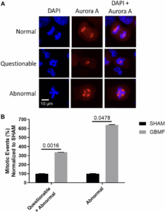 New Radiofrequency Therapy Slows Glioblastoma Growth and Targets Tumor Stem Cells