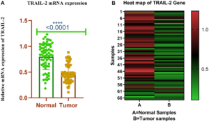 TRAIL-R2 Silencing Linked to More Aggressive Breast Cancer