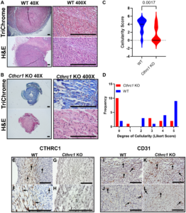 Microenvironmental CTHRC1 has a pro-tumorigenic role in colorectal cancer